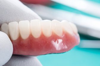 Gingivitis versus parodontitis – Lovett Dental