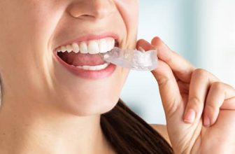 Wat zijn fineren en hoe lang gaan ze mee?